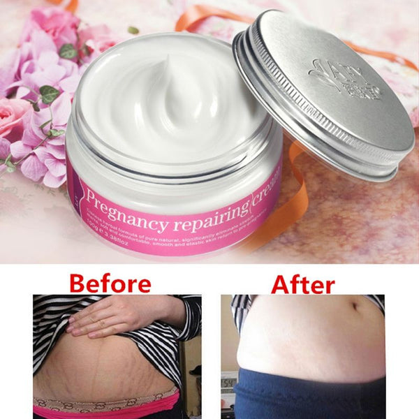 Pregnancy Repair Cream - Stretch Mark Remover